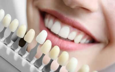 10 Reasons to Visit a Cosmetic Dentist